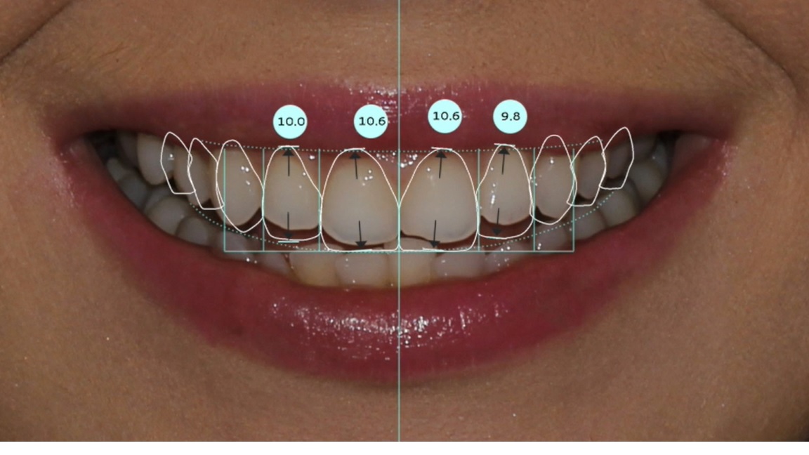 Dijital Gülüş Dizaynı Dijital Gülüş Dizaynı
