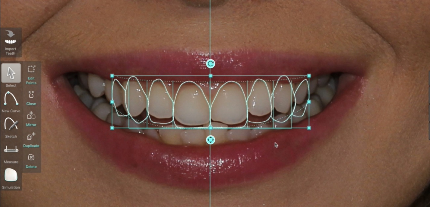 Smile Design Smile Design
