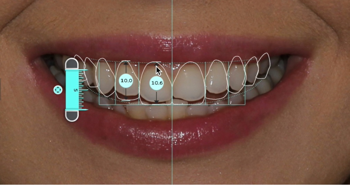 Smile Design Smile Design