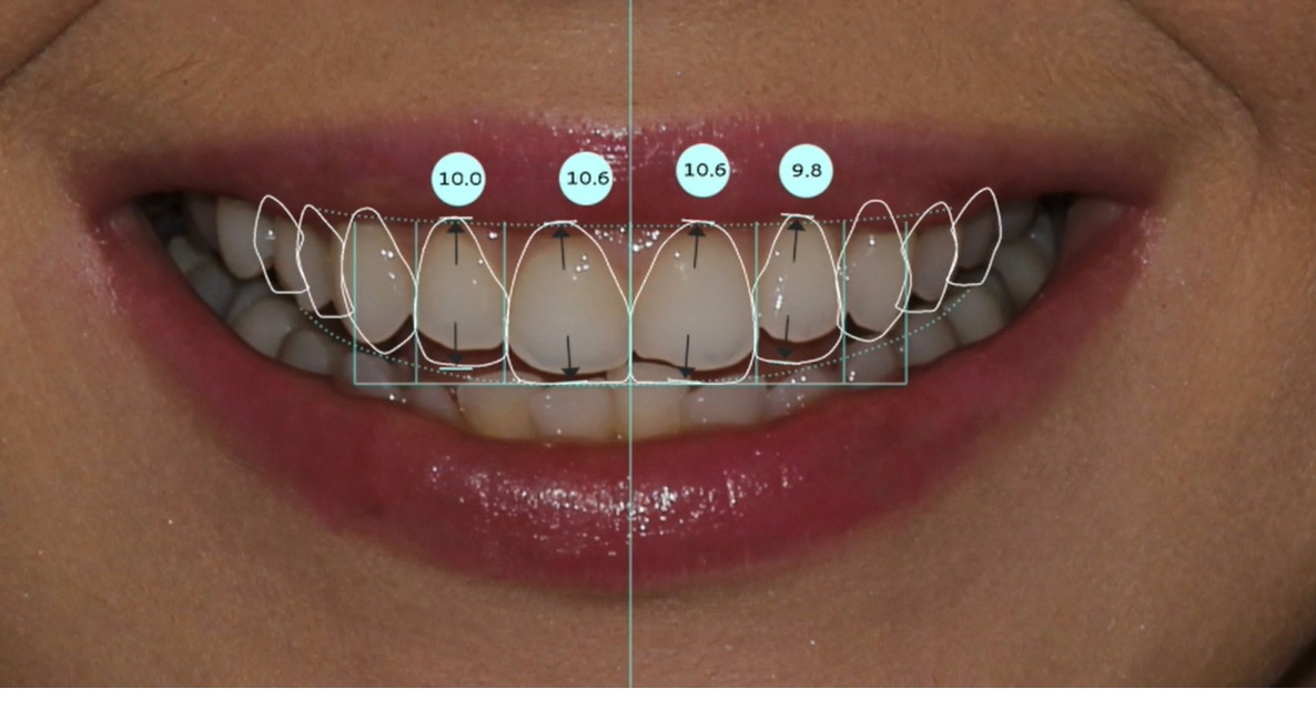 Smile Design Smile Design
